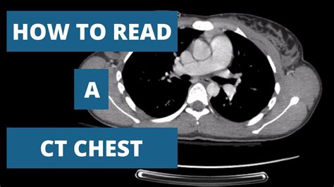 who reads a ct scan
